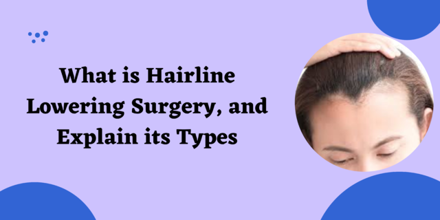What is Hairline Lowering Surgery, and Explain its Types