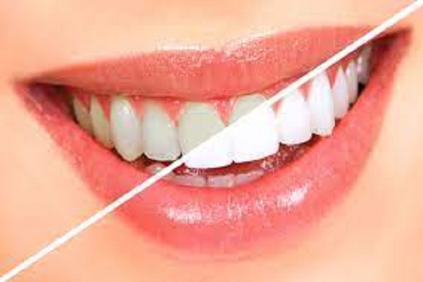 cosmetic dentistry houston tx